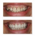 /album/cosmetic-dentistry/cosmatic-dental-1-jpg/